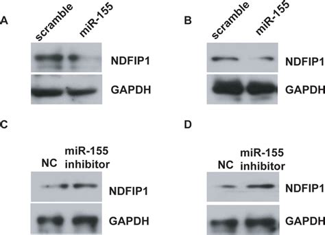 MiR 155 Downregulates NDFIP1 Expression In Uveal Melanoma Cells A And