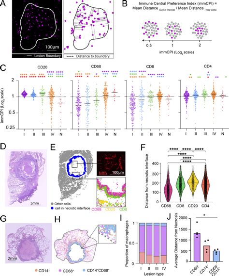 Spatial Organization Of CD68 Macrophages Is Lesion Type Dependent