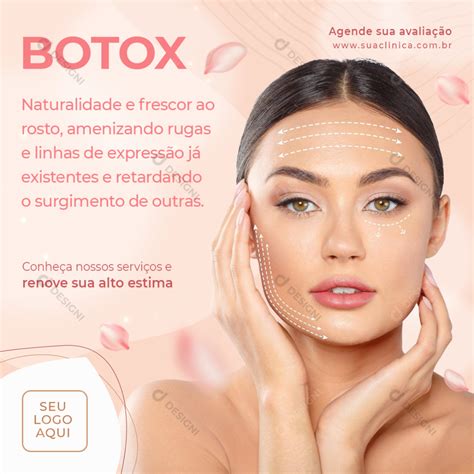 Botox Naturalidade e Frescor Social Media PSD Editável download