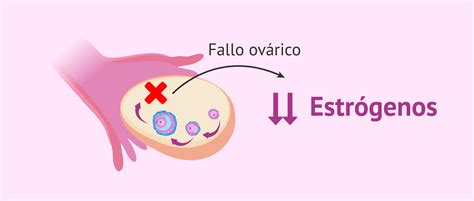 Qué es la insuficiencia ovárica precoz Causas y tratamiento