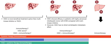 Advanced Hepatocellular Carcinoma Subdivision And Its Optimal Treatment