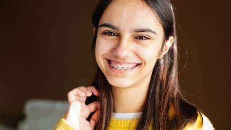 Metal Braces for Teens - Saperstein Orthodontics