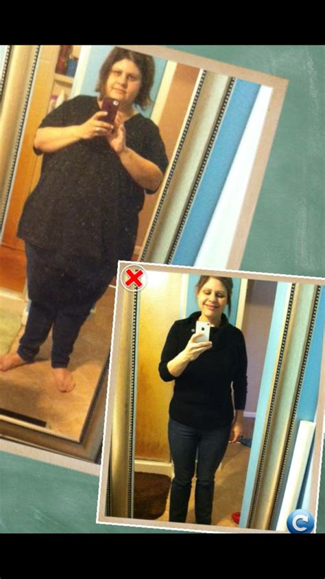 Before and after | American Bariatrics Support Group