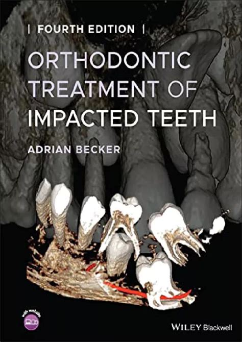 PPT PDF READ Orthodontic Treatment Of Impacted Teeth PowerPoint