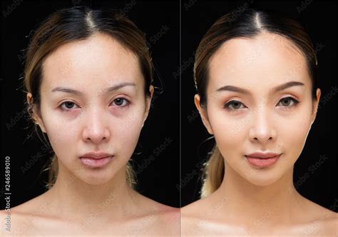 Asian Woman before after applying make up hair style. no retouch, fresh face with acne, lips ...