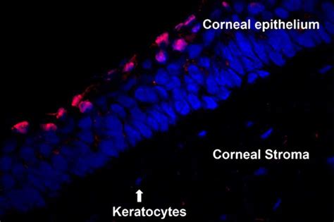 Shedding Light On A Novel Microbial Keratitis Treatment Strategy