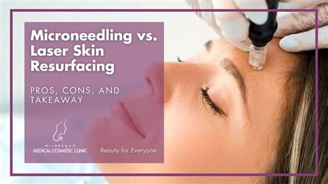 Microneedling Vs Laser Skin Resurfacing Pros And Cons Medspa And Skin