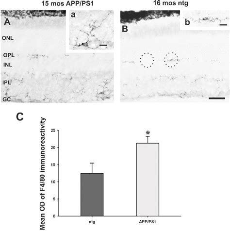 Figure From Amyloid Deposition And Functional Impairment In The