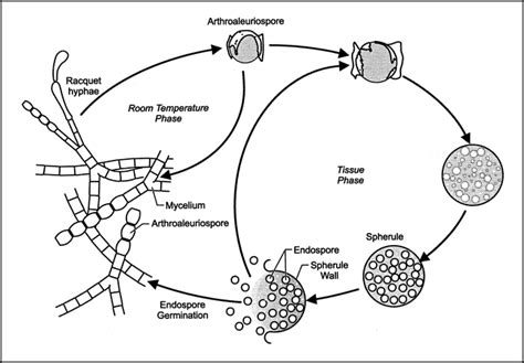 Mr Imaging Of Acute Coccidioidal Meningitis American Journal Of Neuroradiology