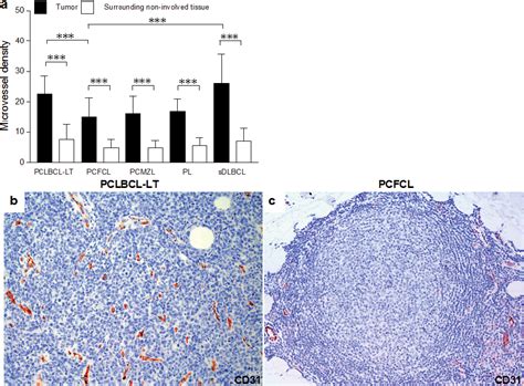 Microvessel Density And Expression Of Vascular Endothelial Growth