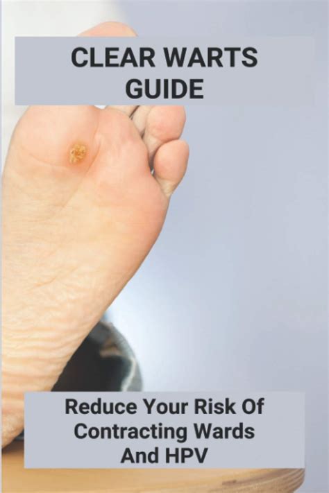 Clear Warts Guide Reduce Your Risk Of Contracting Wards And Hpv Does