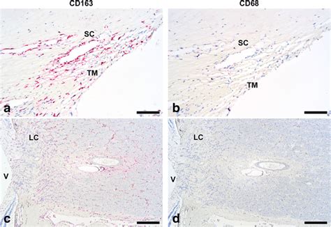 Immunohistochemical Localization Of Cd163 And Cd68 Cells In The Download Scientific Diagram