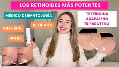 TRETINOINA ADAPALENO TRIFAROTENO LOS RETINOIDES MÁS POTENTES