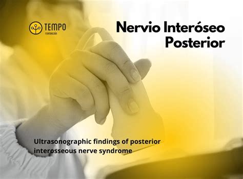 Nervio interóseo posterior by Tempo Formación