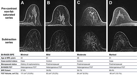 Association Of Breast Cancer Odds With Background Parenchymal