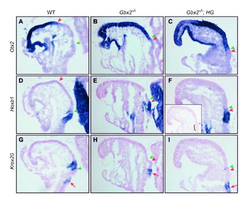 Partial Overlapping Of The Expression Domains Of Otx2 And Hoxb1 In