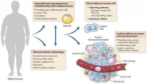 Obesity And Cancer Cancer World Archive