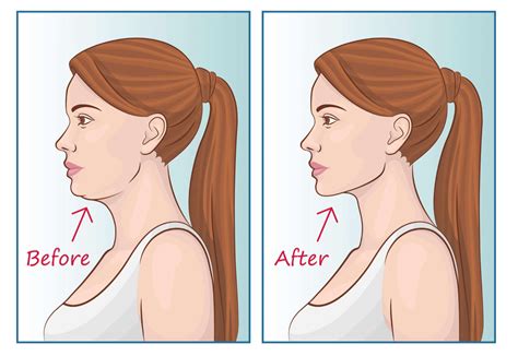 What Is Mewing And How It Can Improve Your Jawline Rockjaw®