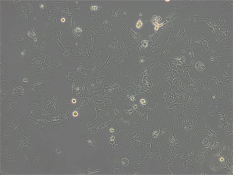 Hs 578T Cells
