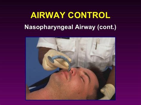 Airway Adjuncts And Management In Acls