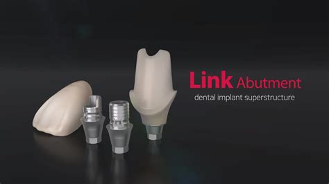 Dental Implant Superstructure Link Abutment Youtube