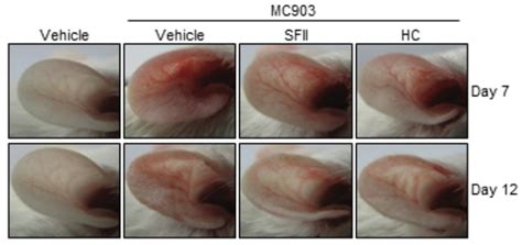 Calcipotriol MC903 Induced Atopic Dermatitis AD Model Creative