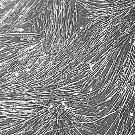 Human Skeletal Muscle Satellite Cells