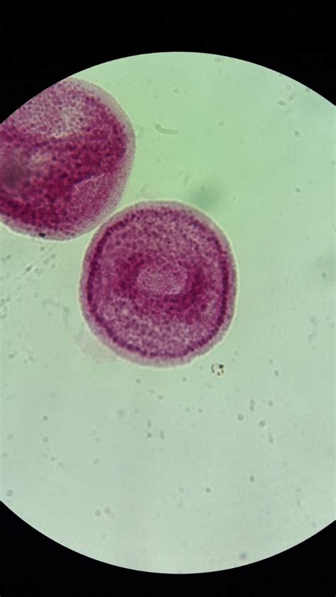 Blastula