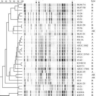 Simplified dendrogram of AFLP profiles of C botulinum group I n ϭ