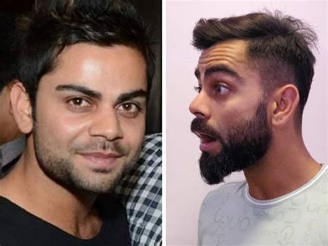 Virat Kohli Before After