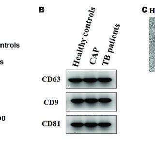 | Characterization of small extracellular vesicles derived from the ... 