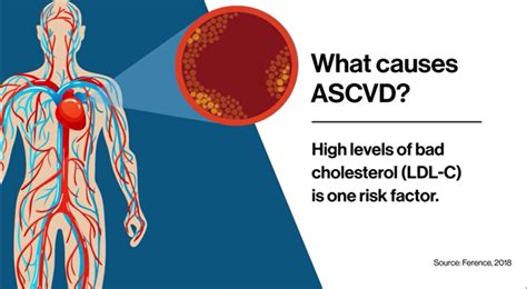 FDA approves Novartis Leqvio® (inclisiran), first-in-class siRNA