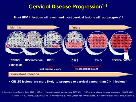 2012 Cervical Cancer Screening Guidelinesimplications For Primary Care Practitioners