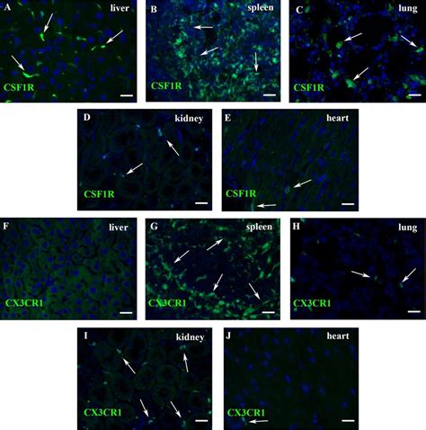 Use Of The CSF1R EGFP And CX3CR1GFP Reporter Mice To Identify Mouse