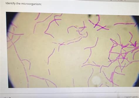 Solved Identify the microorganism: 교 쇄 1 out of 1 points O | Chegg.com 