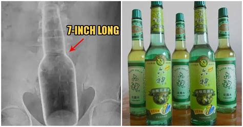 Man Gets Inch Bottle Stuck Up His Rectum After He Tried Scratching His Ass With It WORLD