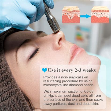 Snapklik Upgraded Diamond Microdermabrasion Machine Mcwdoit 65