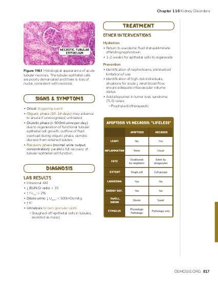 Renal papillary necrosis: Video, Causes, & Meaning | Osmosis