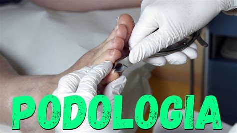 Podologia Live Como Tratar Um Granuloma Curso F Rmula Podologia De