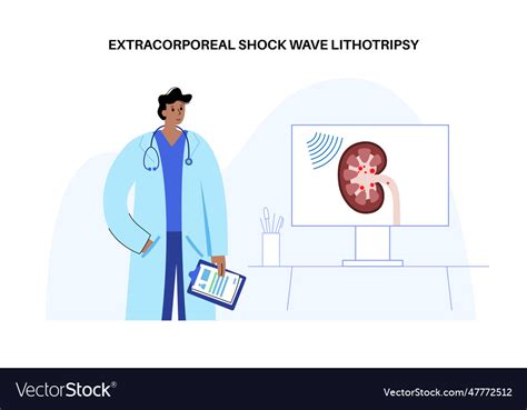 Lithotripsy procedure concept Royalty Free Vector Image