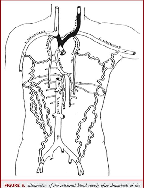 Pdf History Of The Vertebral Venous Plexus And The Significant