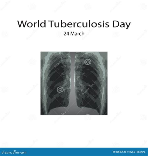 Tuberculosis Tb Infographics Vector Illustration Cartoondealer