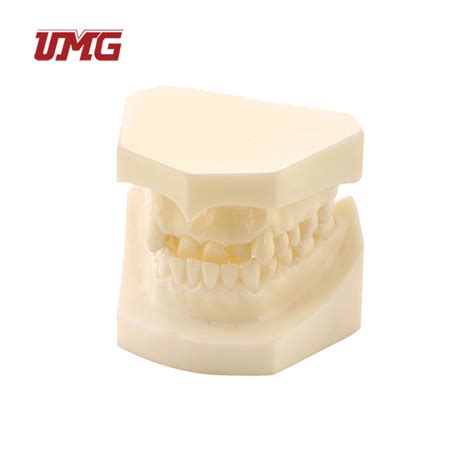 Dental Demonstration Teeth Malocclusion Jaw Model China Malocclusion