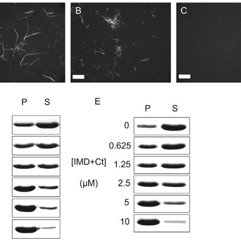 In Vitro Filament Bundling A C Fluorescently Labelled Actin