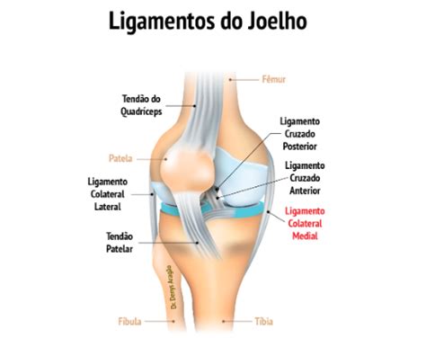 O Que Ligamento Colateral Medial Do Joelho Lcm Dr Denys Arag O