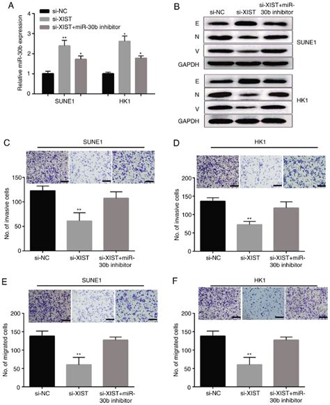 Lncrna Xist Knockdown Suppresses Npc Cell Invasion And Migration By