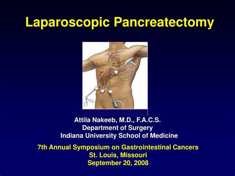 Ppt Laparoscopic Pancreatectomy Powerpoint Presentation Id447449