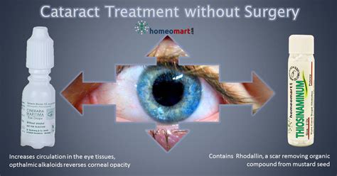 Cataracts treatment without surgery , new alternative treatments ...