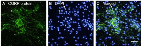 Dorsal Root Ganglia Isolation And Primary Culture To Study