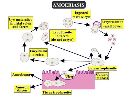 Amoebiasis Signs And Symptoms